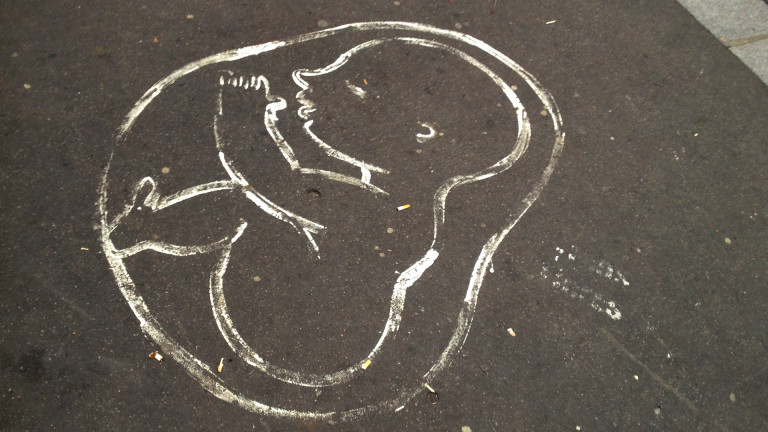 Abtreibungsverbot Embryo – Werk eines unbekannten Strassenmalers | © 2015 Georges Scherrer