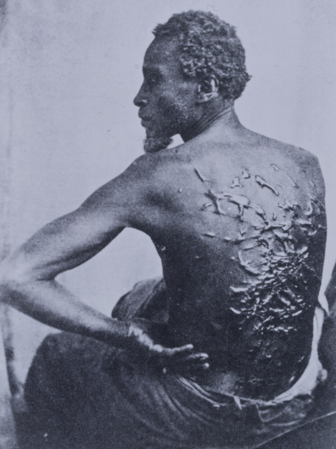 US-Amerikanischer Sklave, der seinem Meister entronnen ist, 1863