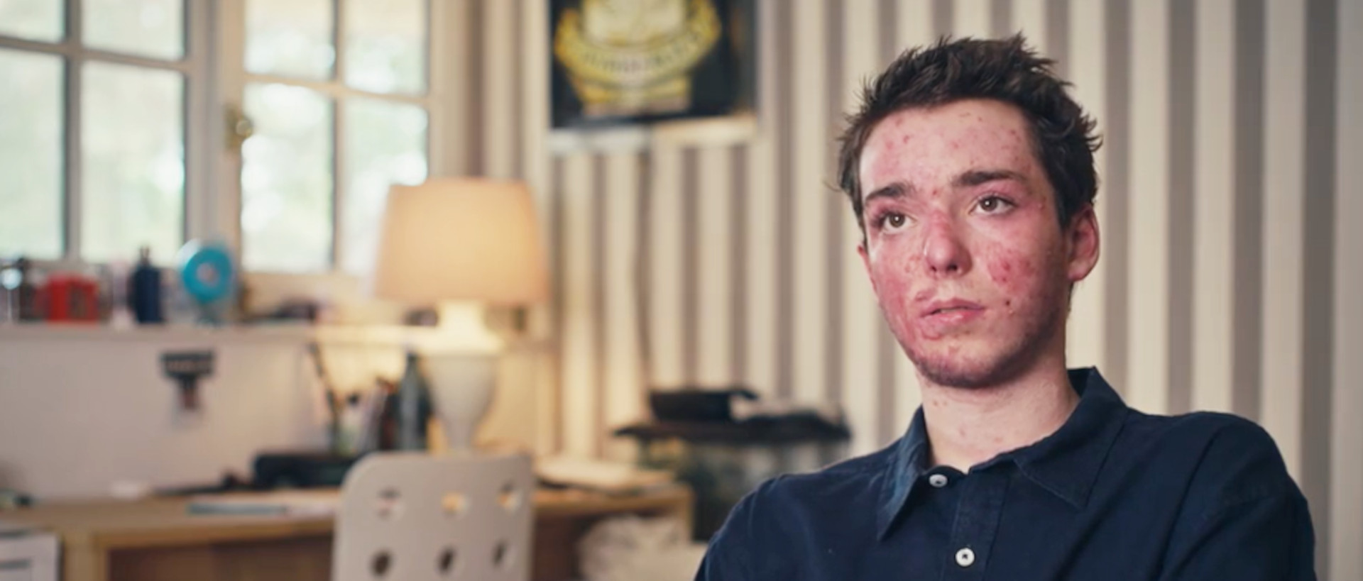 Der 16-jährige Valentin überlebte mit schwersten Brandverletzungen die Feuerkatastrophe von Crans-Montana.